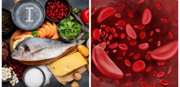 Alimentos Para Combater A Anemia Confira As Melhores Op Es Ricas Em