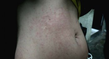 A mulher contou que foi derrubada no chão, teve a blusa rasgada e sofreu vários arranhões pelo corpo