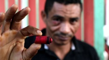 Cosme, caminhoneiro que estava no Ceasa, foi atingido no olho
