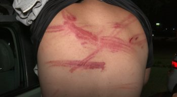 Ferimentos são visíveis nas costas de uma das vítimas