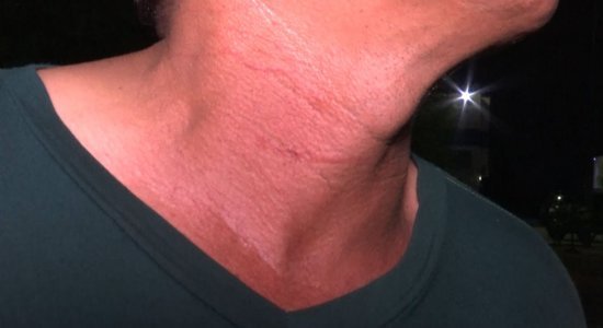 Suspeito feriu pescoço do mototaxista com faca