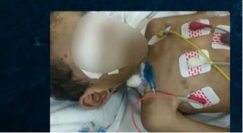 A polícia investiga se a morte do garoto foi em decorrência aos maus tratos causados por parentes