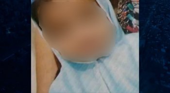 A criança foi internada, mas não resistiu aos ferimentos e morreu