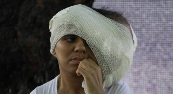 Taís Fernanda dos Santos luta contra um neurofibroma