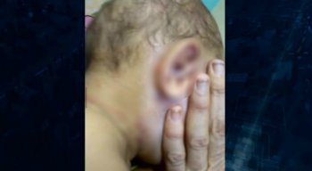 O bebê de 7 meses já recebeu alta do hospital