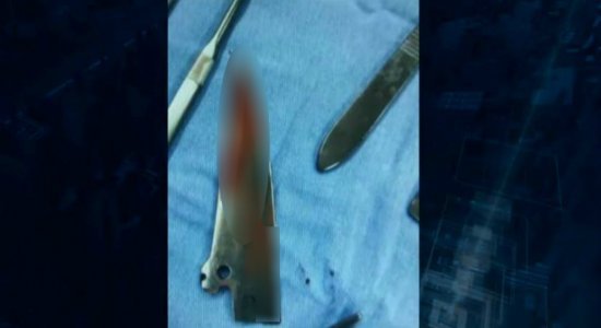 Homem fica 45 horas com faca cravada nas costas em hospital
