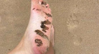 Pessoas denunciaram o reaparecimento de óleo em praias do litoral pernambucano