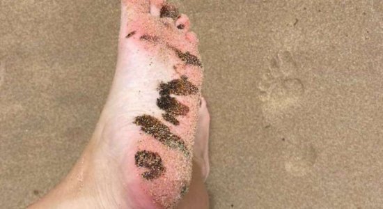 Óleo volta a aparecer em praias do Litoral Sul de Pernambuco