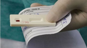 ANS determinou que planos de saúde devem cobrir o teste