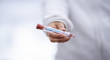 teste coronavírus