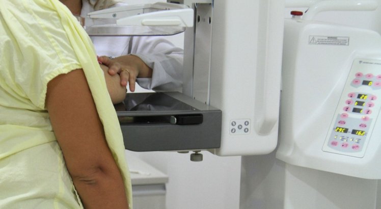 Femama alerta que mulheres esperem um período para realizar mamografia após vacina contra covid-19; saiba mais