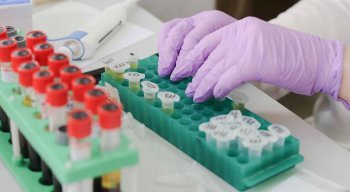 De acordo com o texto, durante a pandemia está dispensada a apresentação de receita física,