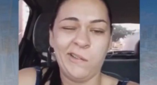 Vídeo de mulher com a boca torta após ir ao dentista viraliza