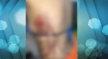 Ela foi agredida no rosto e teve um copo estilhaçado nas costas