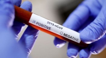 Estado totaliza 9.459 mortes pelo novo coronavírus