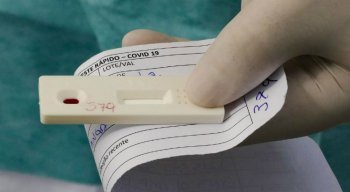Nas últimas 24 horas, foram registrados 52.035 novos diagnósticos positivos da covid-19