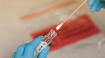 Viajantes e grupos de risco são submetidos a testes retais para detectar Covid-19