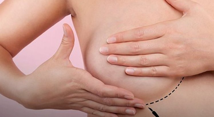 Câncer de mama supera o de pulmão e já é o mais comum no mundo, segundo OMS