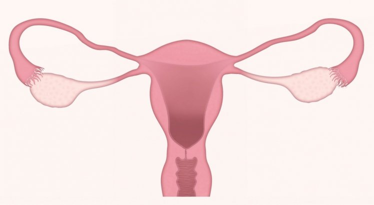 Câncer de ovário: entenda quais são os sintomas e como funciona tratamento