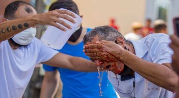 Daniel Campelo, 51, passava próximo à manifestação quando acabou atingido pelo tiro de bala de borracha no olho esquerdo