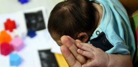 sindrome-congenita-do-zika