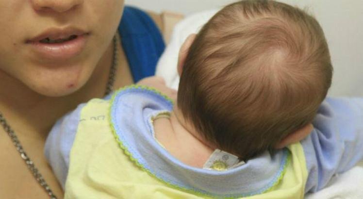 sindrome-congenita-do-zika