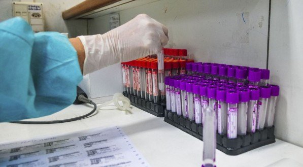 Estudos apontam que pacientes com lúpus ou artrite não correm risco maior diante do coronavírus