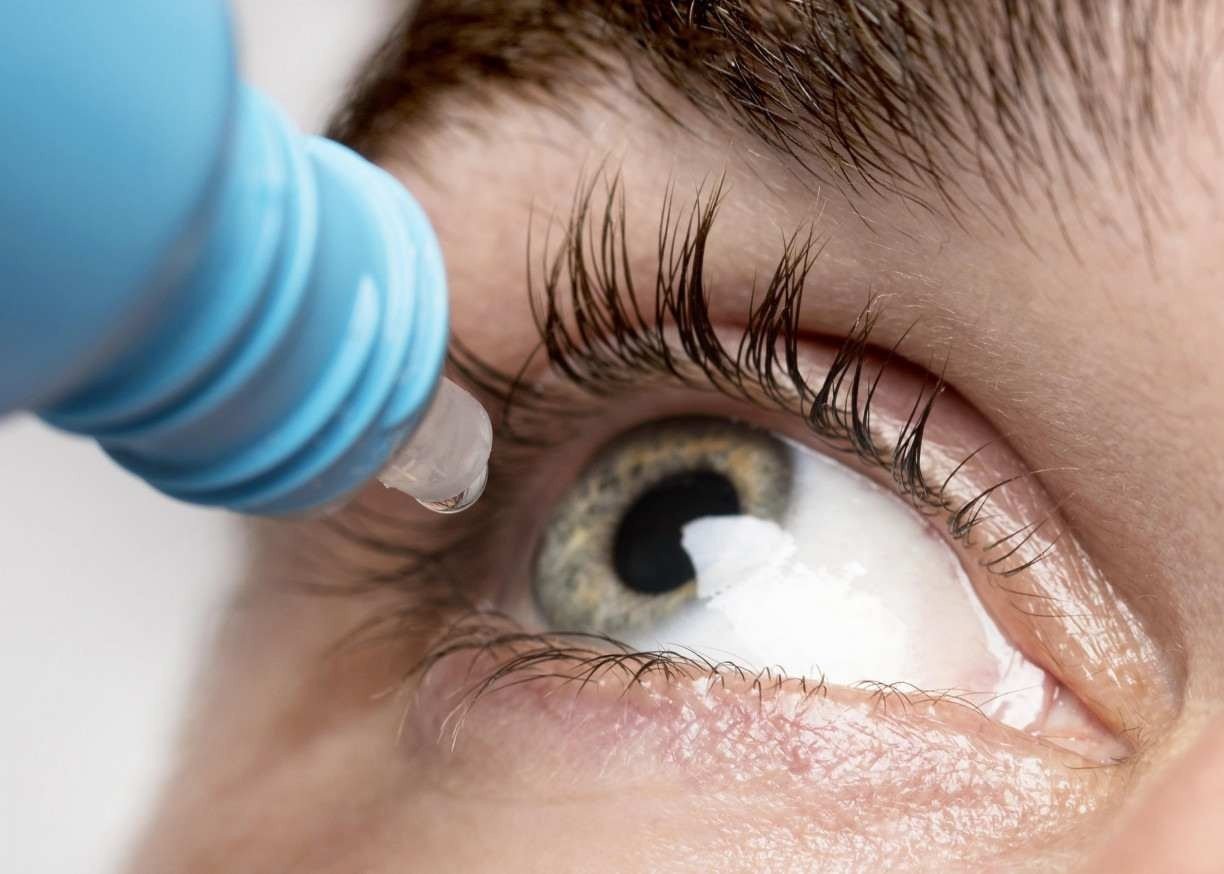glaucoma