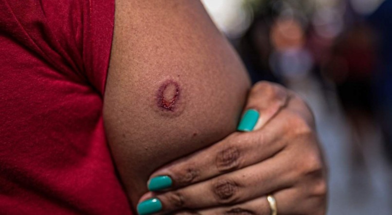 Caso recente de desrespeito aos direitos humanos, no Recife, ocorreu quando a PM atirou com balas de borracha em manifestantes que participaram de um protesto contra o governo Bolsonaro e em defesa da vacina&ccedil;&atilde;o em massa contra a covid-19