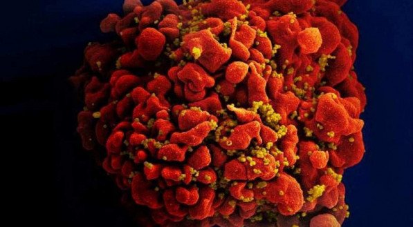 HANDOUT / NATIONAL INSTITUTES OF HEALTH / AFP