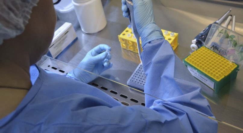 EXAMES Amostras coletadas de pacientes com sintomas da varíola estão sendo encaminhadas para o Laboratório Central de Saúde Pública de PE