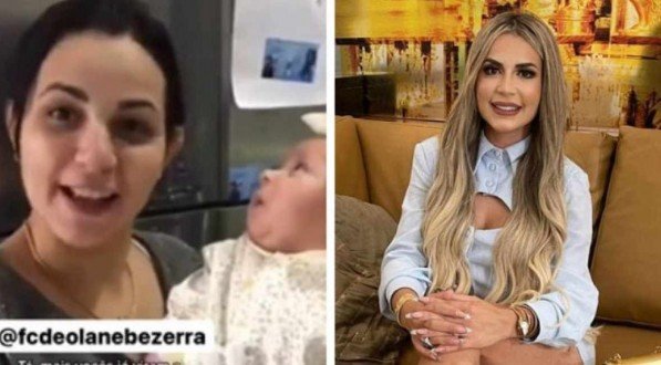 Antes e depois da advogada Deolane Bezerra