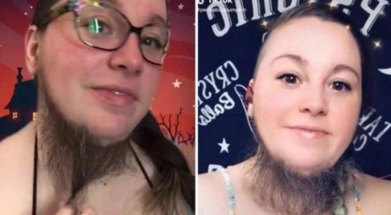Mulher barbada faz sucesso com v&iacute;deos no Tik Tok