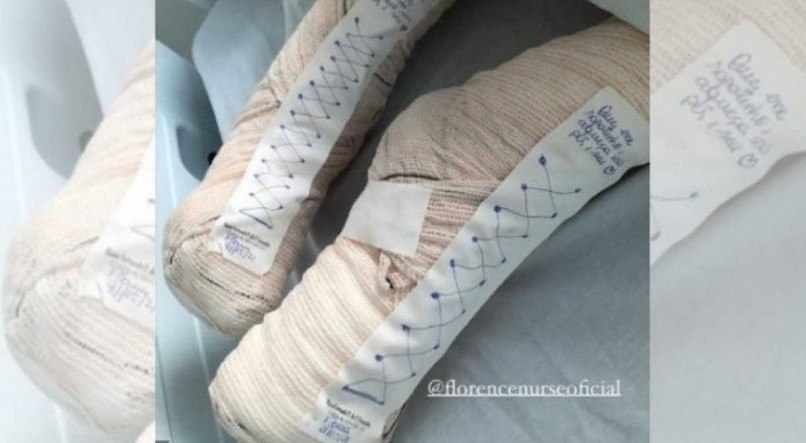 Enfermeira faz sapatinhos improvisados para aquecer p&eacute;s de paciente