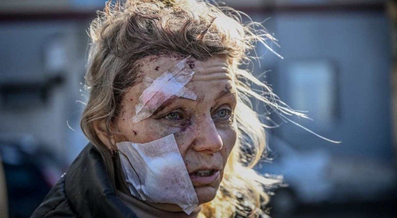 Uma mulher ferida do lado de fora de um hospital após o bombardeio na cidade de Chuguiv, no leste da Ucrânia