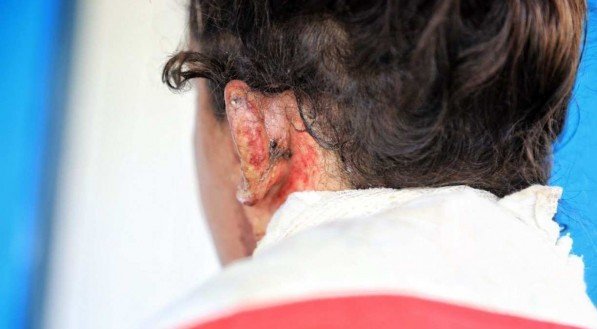 Muitas mulheres pedem medida protetiva, mas não querem investigação do agressor, diz polícia