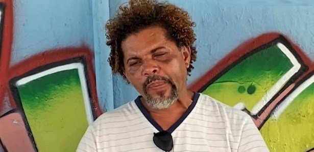 Mendigo De Planaltina Revela Tudo Que Aconteceu Antes De Ser Agredido