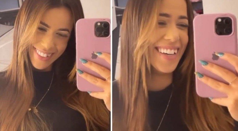 Larissa Tomásia mostrou o dente quebrado nos Stories 