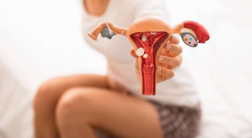 Endometriose atinge uma a cada dez brasileiras