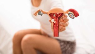 endometriose