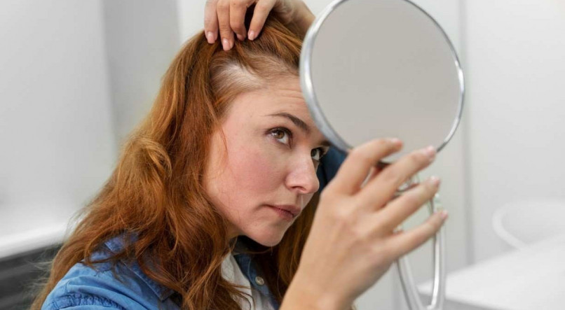 Shampoos com ativos terapêuticos que penetram no folículo podem ajudar contra a queda de cabelo