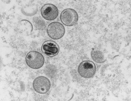 A varíola dos macacos é uma zoonose viral