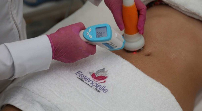  SERVIÇO Radiofrequência é um dos procedimentos estéticos oferecidos pela clínica Essencialle