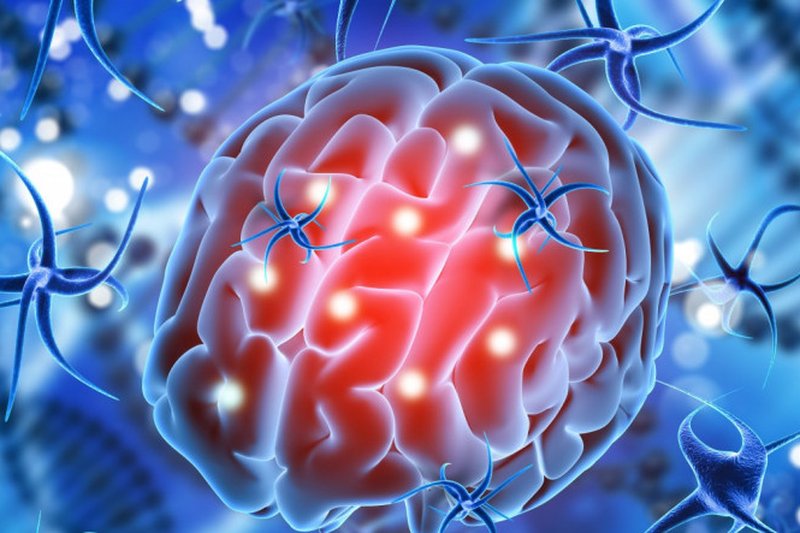 O acidente vascular cerebral pode ocorrer pela obstrução de um vaso sanguíneo no cérebro ou seu rompimento