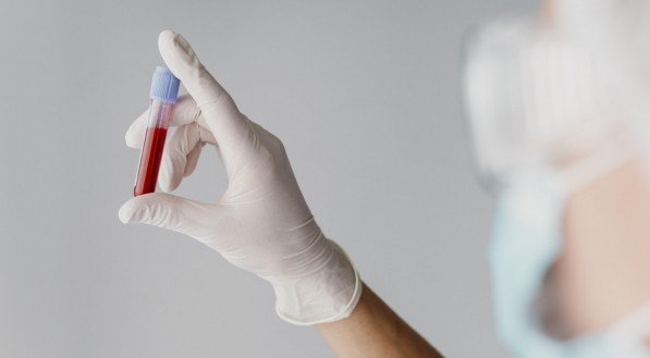 A prevenção é fundamental e pode incluir a realização de exames de rastreamento regularmente, adotar uma dieta rica em fibras e pobre em gorduras saturadas 