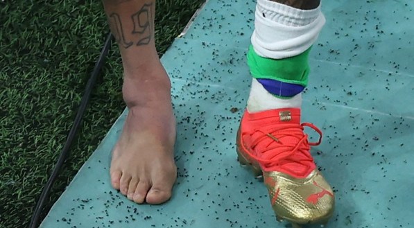Neymar sofreu uma entorse no tornozelo direito na estreia da sele&ccedil;&atilde;o brasileira