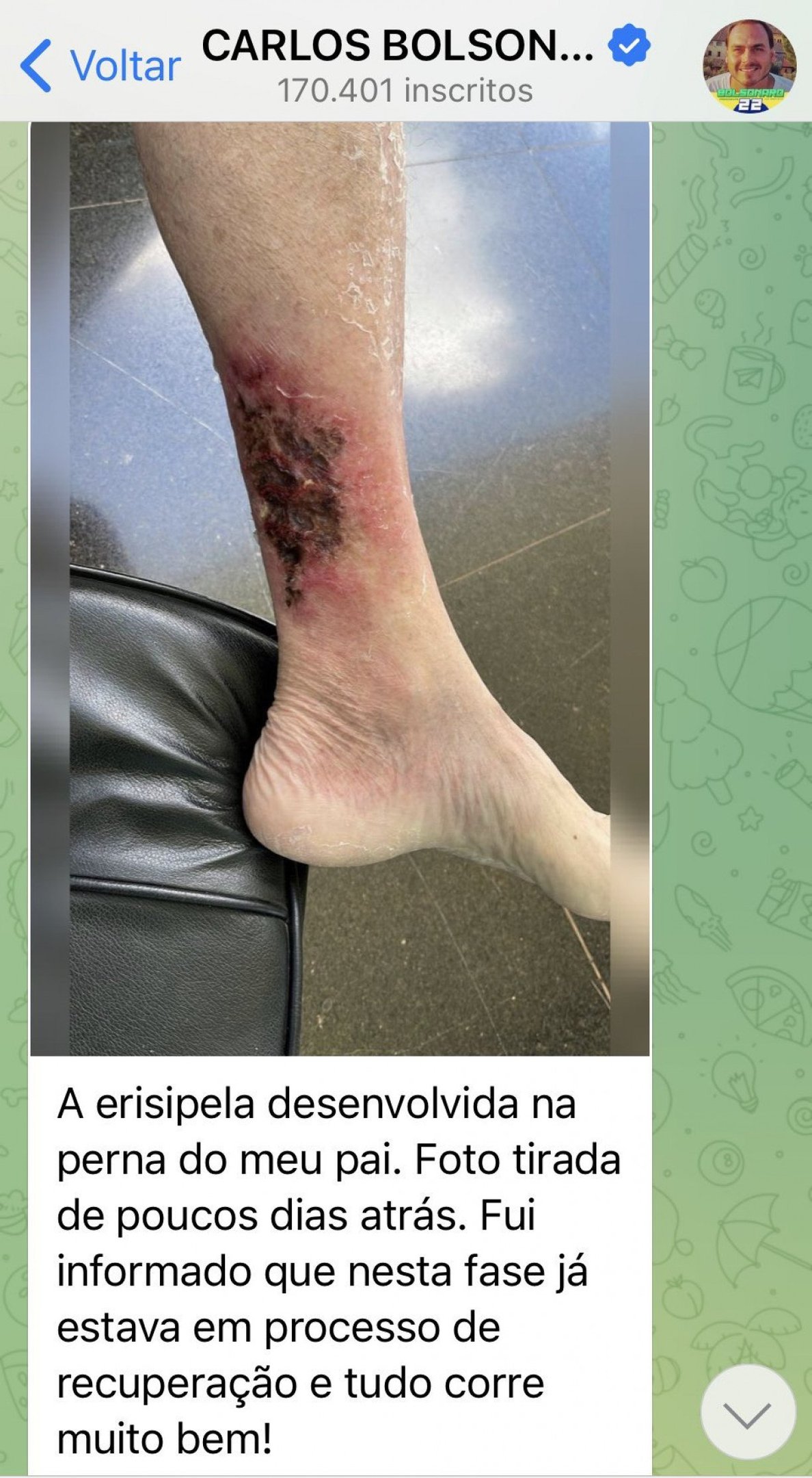 Reprodução/Telegram Carlos Bolsonaro