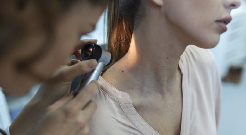 Inca estima que 704 mil casos de câncer de pele não melanoma sejam registrados no próximo triênio (2023-2025).