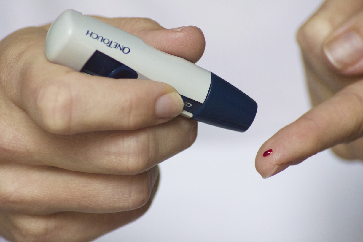 Como funciona o exame de hemoglobina glicada? Veja valores de diabetes