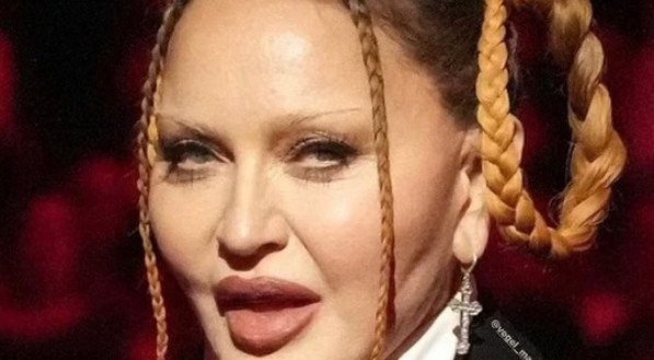 MADONNA ANTES E DEPOIS: Aparência da cantora ASSUSTA fãs; veja FOTOS de Madonna mais nova e atualmente 